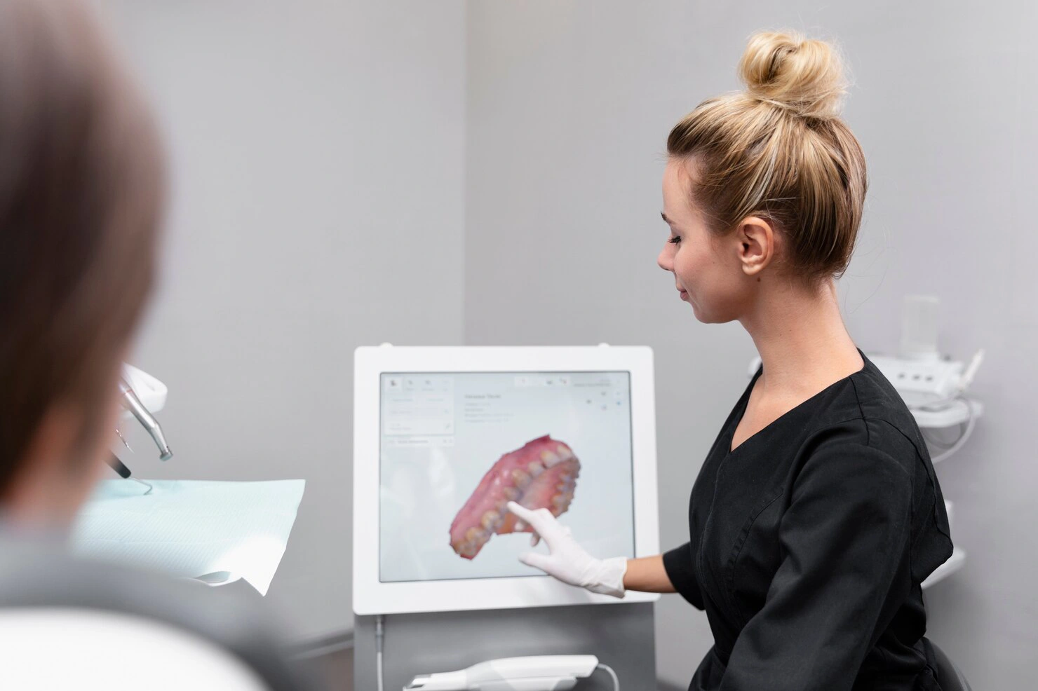 Digital Intraoral Scanner