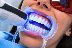 Yellow Teeth Whitening Treatment?