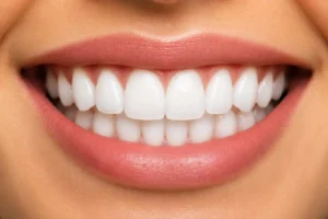 Yellow Teeth Whitening Treatment?