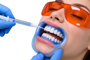 Applying The Whitening Gel