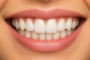 Yellow Teeth Whitening After