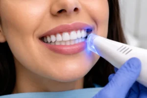 Yellow Teeth Whitening After