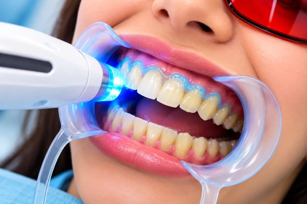 Yellow Teeth Whitening Before